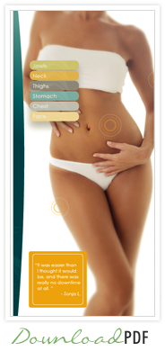 SmartLipo