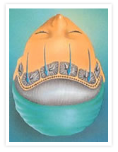 Browlift Image