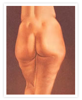 Tummy Tuck Photos